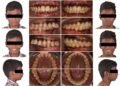 Revolutionizing Orthodontic Education and Care at Saveetha, Chennai
