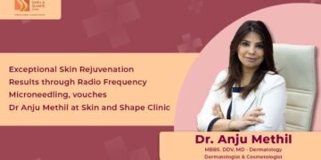 Exceptional Skin Rejuvenation Results through Radio Frequency Microneedling, vouches Dr. Anju Methil, Skin and Shape Clinic