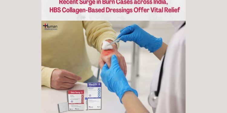Human BioSciences Raises Awareness on Burn Injuries and Life-Saving Solutions