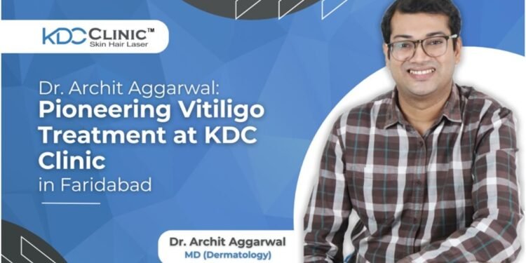 Dr. Archit Aggarwal: Pioneering Vitiligo Treatment at KDC Clinic in Faridabad