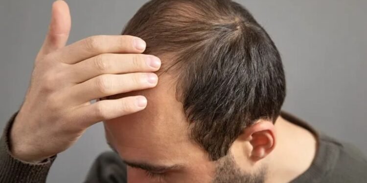 Dr Batra’s® Healthcare Introduces World’s Most Advanced Treatment for Targeted Hereditary Hair Loss: XOGEN