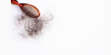 Nutritional Deficiencies and Hair Fall – The age-old link