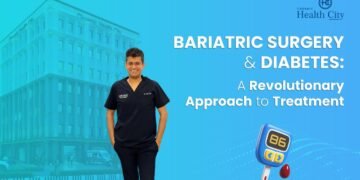 Bariatric Surgery and Diabetes: A Revolutionary Approach to Treatment