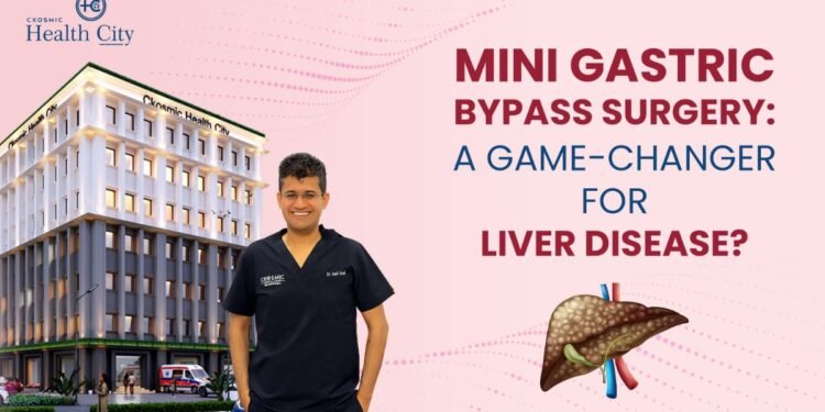Mini Gastric Bypass Surgery: A Game-Changer for Liver Disease?