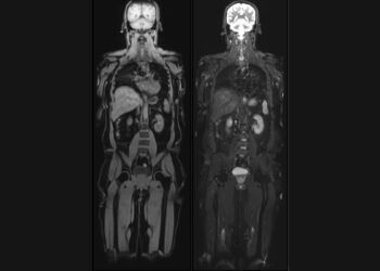 Aarthi Scans and Labs Launches ‘Vital MRI’: A New Chapter in Preventive Healthcare with Full Body MRI Scans