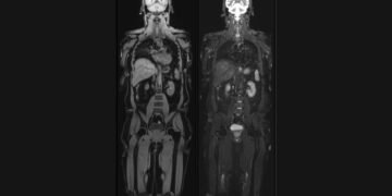 Aarthi Scans and Labs Launches ‘Vital MRI’: A New Chapter in Preventive Healthcare with Full Body MRI Scans