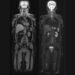Aarthi Scans and Labs Launches ‘Vital MRI’: A New Chapter in Preventive Healthcare with Full Body MRI Scans