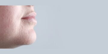 How to Choose the Right Face Wash for Sensitive or Dry Skin?