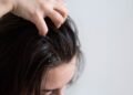 Itchy Scalp and Hair Loss: A Connected Problem