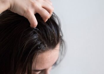 Itchy Scalp and Hair Loss: A Connected Problem