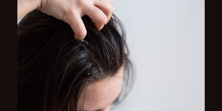 Itchy Scalp and Hair Loss: A Connected Problem