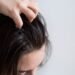 Itchy Scalp and Hair Loss: A Connected Problem