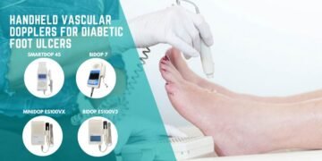 How Handheld Vascular Dopplers Improve Diabetic Foot Ulcer Diagnosis