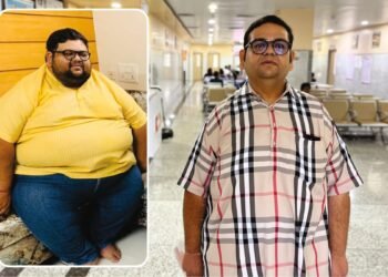 NOBESITY Surgery Helps Ahmedabad Resident Lose 109 Kg, Transforming Health and Life