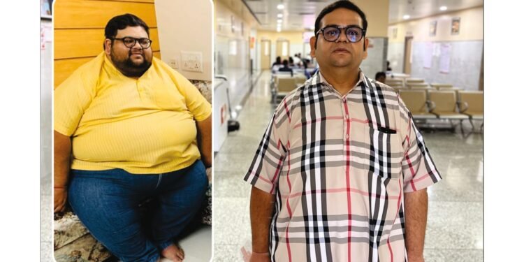 NOBESITY Surgery Helps Ahmedabad Resident Lose 109 Kg, Transforming Health and Life