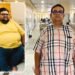 NOBESITY Surgery Helps Ahmedabad Resident Lose 109 Kg, Transforming Health and Life