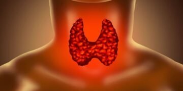 Throat Cancer vs. Common Cold: Understanding the Difference in Symptoms