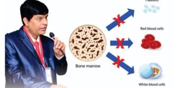 Advanced Homeopathy treatment brings New Hope to Aplastic Anemia Patients: Dr. A.K. Dwivedi’s Efforts Shine