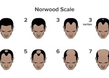 What is Causing Your Hair Fall? Take This Scientifically Backed Hair Loss Quiz