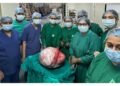 Successful Removal of 18 kg Ovarian Tumour from 68-Year-Old Woman
