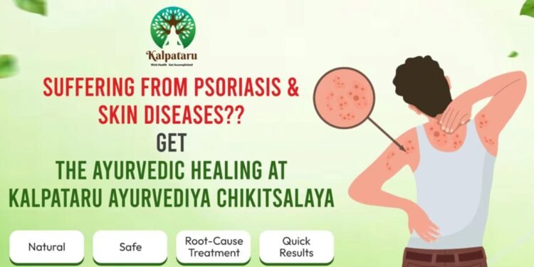 Psoriasis and Skin Diseases – The Ayurvedic Approach at Kalpataru Ayurvediya Chikitsalaya