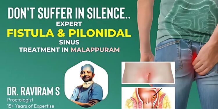 Don’t Suffer in Silence: Expert Fistula & Pilonidal Sinus Treatment in Malappuram