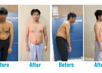 A 31-year-old who lived on a chair… until his spine finally said, ‘Enough’