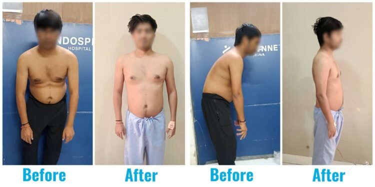 A 31-year-old who lived on a chair… until his spine finally said, ‘Enough’