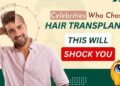 Celebrity Hair Transplant: You’d Never Guess They Had a Hair Transplant- But They Did