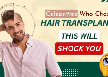 Celebrity Hair Transplant: You’d Never Guess They Had a Hair Transplant- But They Did