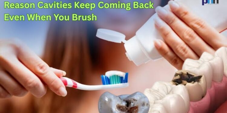 The Real Reason Cavities Keep Coming Back Even When You Brush