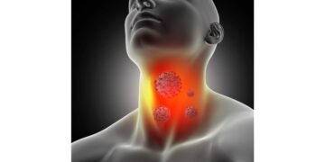 Early Signs and Symptoms of Thyroid Cancer You Should Not Ignore