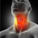 Early Signs and Symptoms of Thyroid Cancer You Should Not Ignore