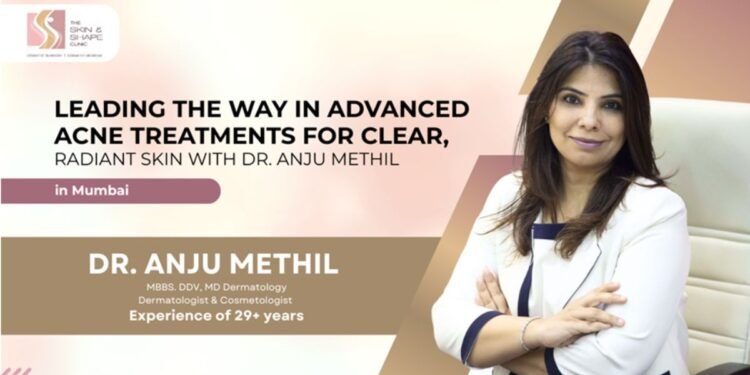 Pioneering Advanced Acne Treatment Solutions for Clear, Glowing Skin with Dr. Anju Methil in Mumbai