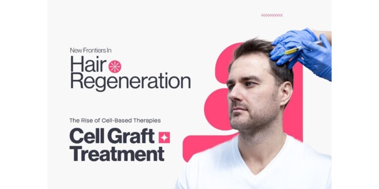 New Frontiers in Hair Regeneration: The Rise of Cell-Based Therapies