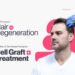 New Frontiers in Hair Regeneration: The Rise of Cell-Based Therapies