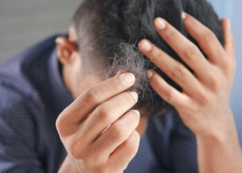 What Are the Main Causes of Hair Fall in Men?