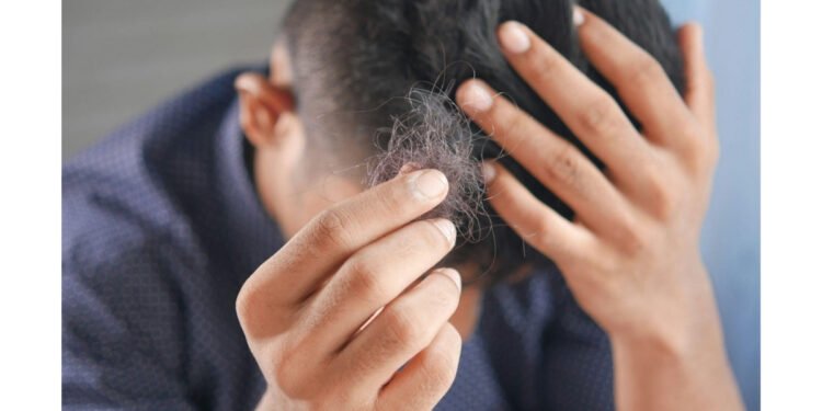 What Are the Main Causes of Hair Fall in Men?