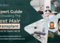 Expert Guide on Choosing the Best Hair Transplant Clinic in Delhi NCR