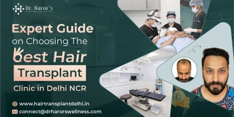 Expert Guide on Choosing the Best Hair Transplant Clinic in Delhi NCR