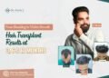 From Shedding to Visible Growth: Hair Transplant Results at 3, 6 and 12 Months