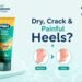 Dry Skin & Cracked Heels: The Everyday Skin Problems Millions of Indian Women Ignore Until They Become Painful